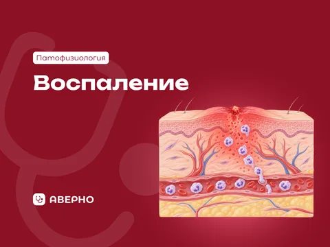 Воспаление: стадии, признаки, исходы